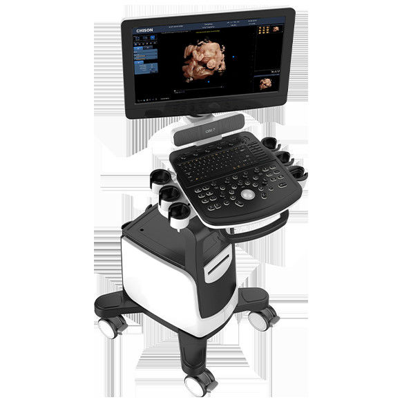 Mesin Ultrasound Doppler Warna LED 19 Inci Chison QBit 7