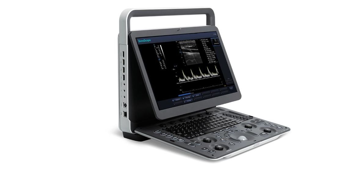 15,6 inci LED SonoScape Portable Color Doppler Ultrasound Machine BW Ultrasound