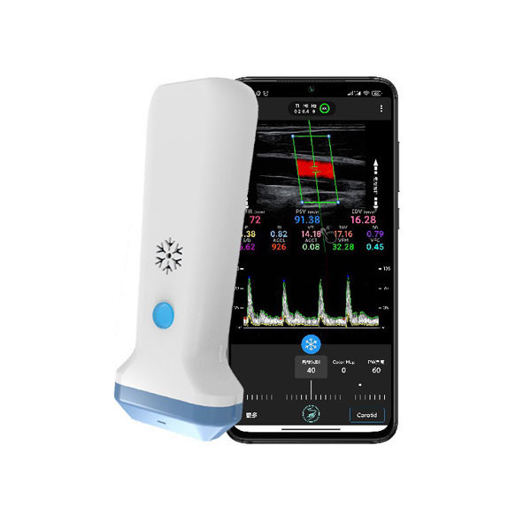 Pemindai Ultrasound Genggam Linier Nirkabel | Probe USG Doppler Warna Portabel 4/8.3/12MHz