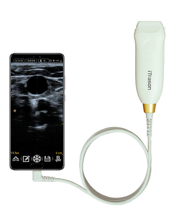 64 Saluran 20mm Depth Handheld Ultrasound Scanner untuk Penilaian Vaskular Periferal dan Akses Vaskular yang Dipandu Ultrasound