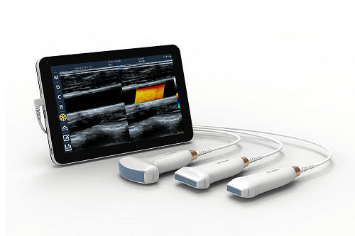 Pemindai Ultrasound Android Nirkabel Portabel 10MHz Dengan Koneksi Tipe-C