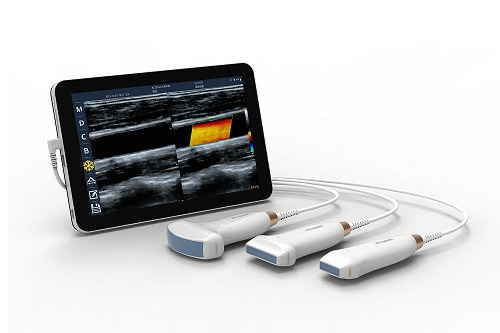 Pemindai Ultrasound Genggam Linier USB Tipe-C 10MHz Probe Ultrasound Android Portabel untuk Vaskular dan POCUS