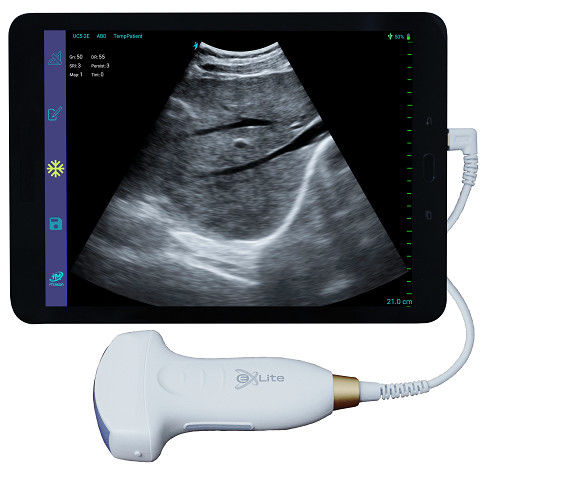 Electronic Convex Array Color Doppler Handheld Ultrasound Scanner 3.5MHz