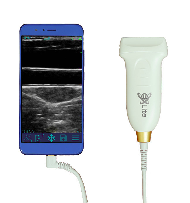 Pemindai Ultrasound Genggam Linier USB Tipe-C 10MHz Probe Ultrasound Android Portabel untuk Vaskular dan POCUS