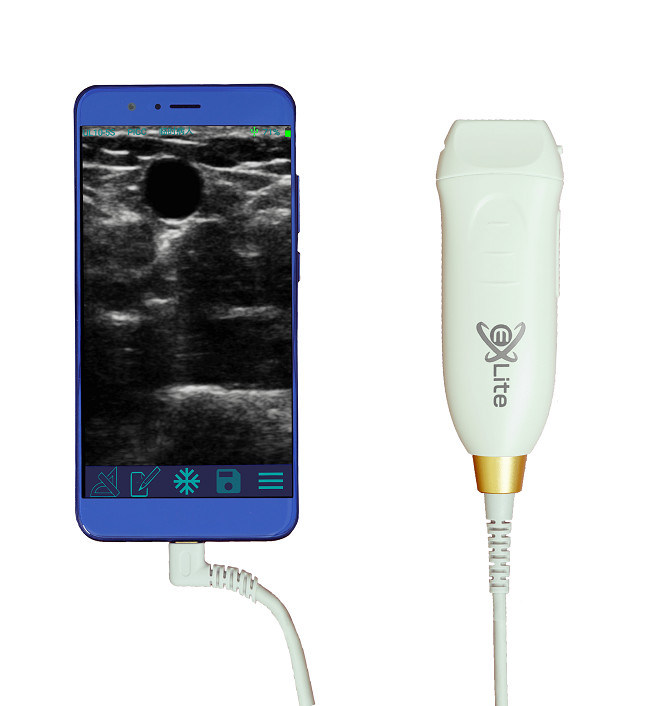 Scanner USG genggam dengan 12MHZ Frekuensi Tinggi Probe Linear untuk Akses Vaskular yang Tepat dan Prosedur Insersi PICC