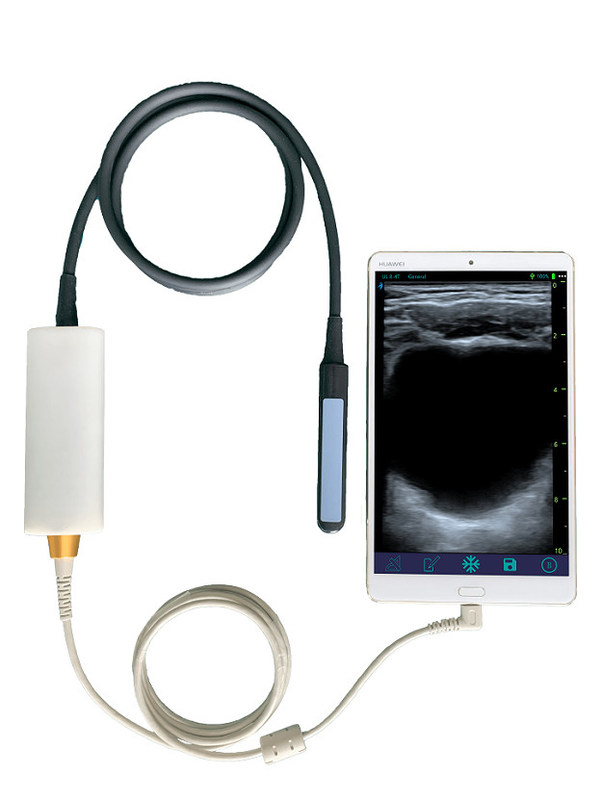 Pemindai Ultrasound Hewan Genggam dengan Probe Rektal Linier untuk Reproduksi Sapi & Kuda