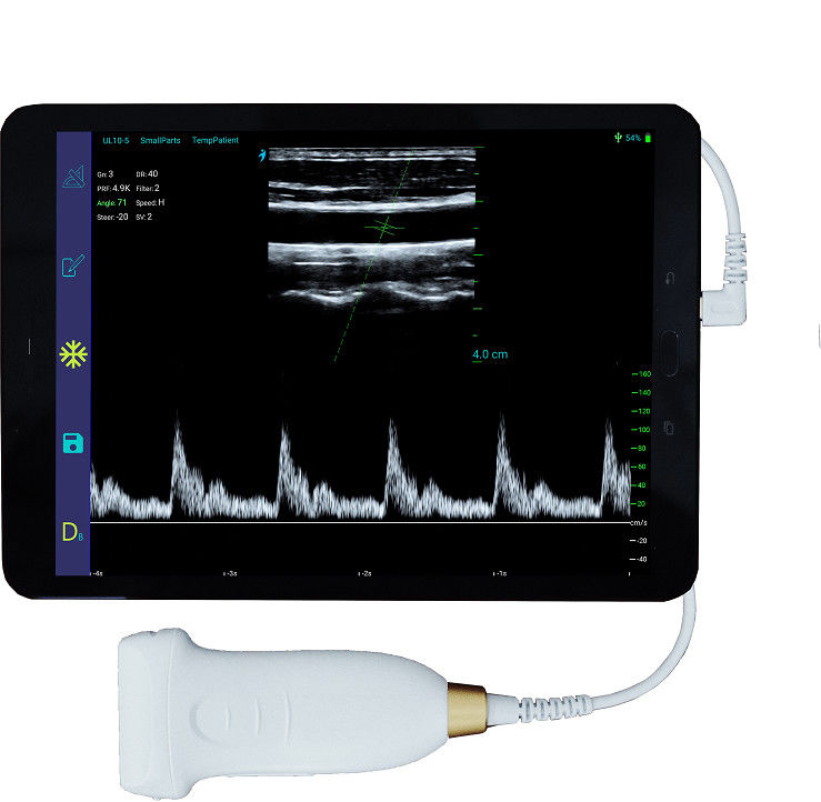 Pemindai Ultrasound Android Nirkabel Portabel 10MHz Dengan Koneksi Tipe-C