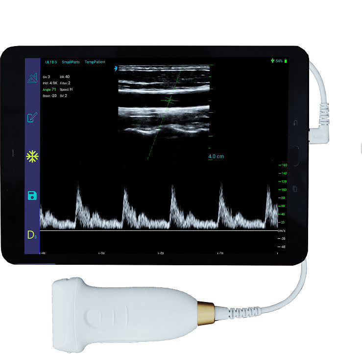 Pemindai Ultrasound Genggam Linier USB Tipe-C 10MHz Probe Ultrasound Android Portabel untuk Vaskular dan POCUS