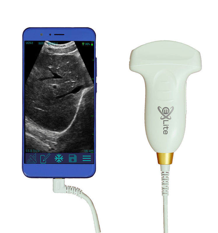 Electronic Convex Array Color Doppler Handheld Ultrasound Scanner 3.5MHz