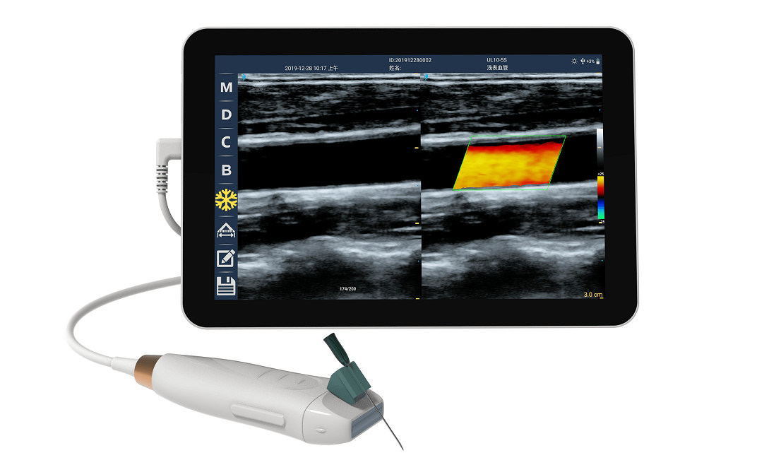 Scanner USG genggam dengan 12MHZ Frekuensi Tinggi Probe Linear untuk Akses Vaskular yang Tepat dan Prosedur Insersi PICC