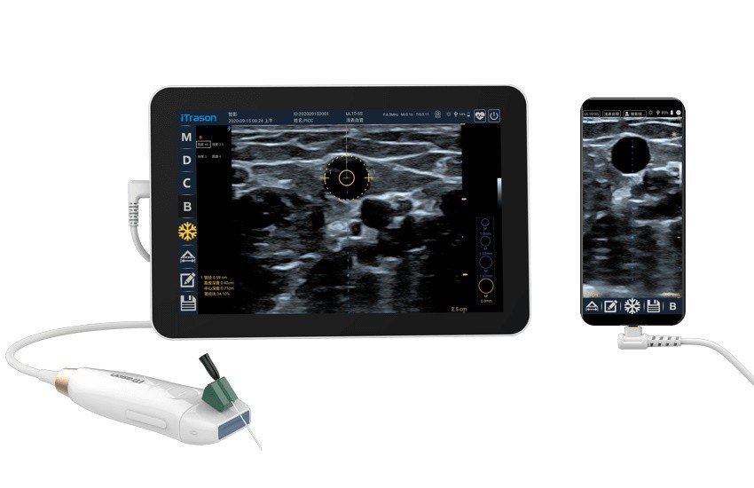 64 Saluran 20mm Depth Handheld Ultrasound Scanner untuk Penilaian Vaskular Periferal dan Akses Vaskular yang Dipandu Ultrasound