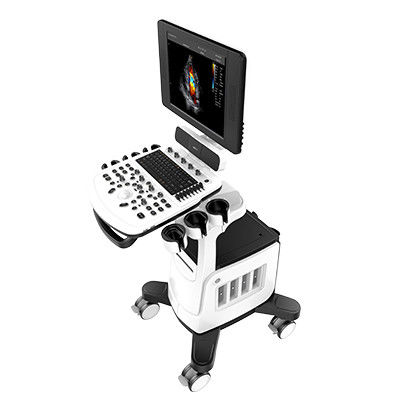 Color Doppler Ultrasound Scanner Chison Qbit 5 Dengan LED 15 Inci