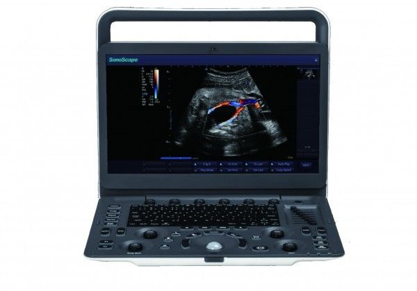 7 Tingkat Pencitraan Mesin Ultrasound Portabel SonoScape E3 Dengan Monitor 15,6 Inci