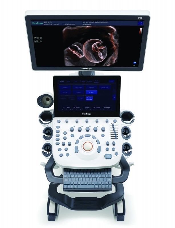 Mesin Ultrasound Doppler Warna Trolley LED Sonoscape P10 21,5''