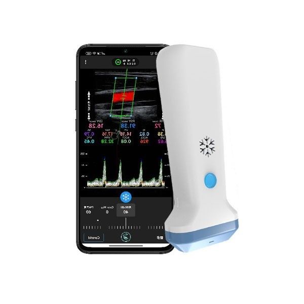 Pemindai Ultrasound Doppler Warna Portabel 12,6cm Untuk Profesional Perawatan Kesehatan