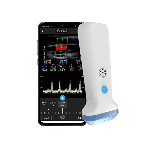 Pemindai Ultrasound Linier Nirkabel Doppler Warna Portabel 12.6Cm Ultrasound POCUS Genggam untuk Profesional Kesehatan