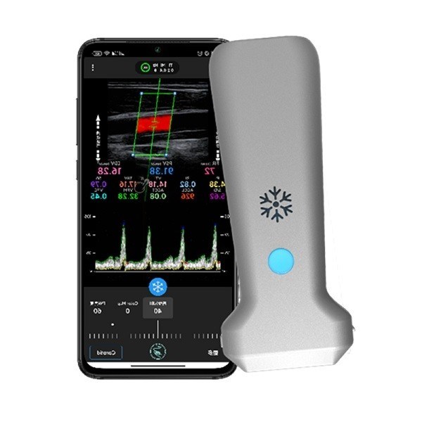 Pemindai Ultrasound Genggam Linier Nirkabel Bersertifikat CE | Probe USG Doppler Warna Portabel 8.3MHz
