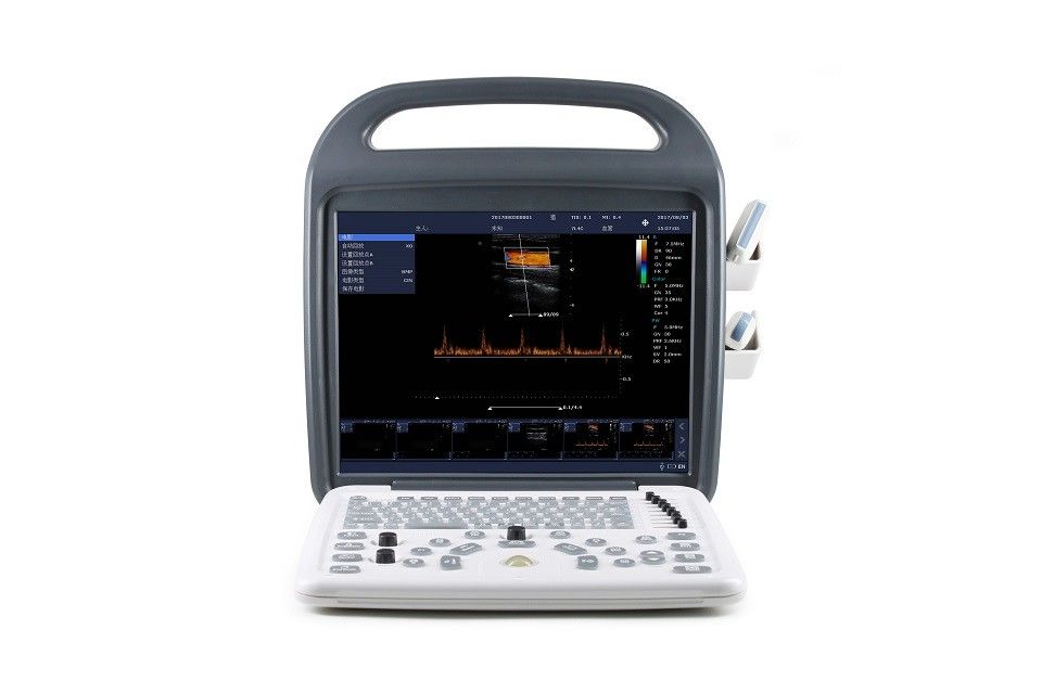 15 '' Monitor LCD Definisi Tinggi Mesin Ultrasound Doppler Warna Portabel 7.5kg