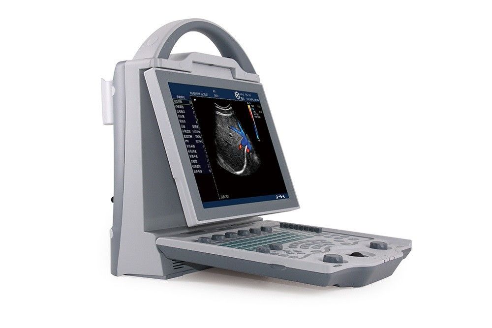 16GB Entry Level 2D Laptop Color Doppler Ultrasound System Untuk Kehamilan