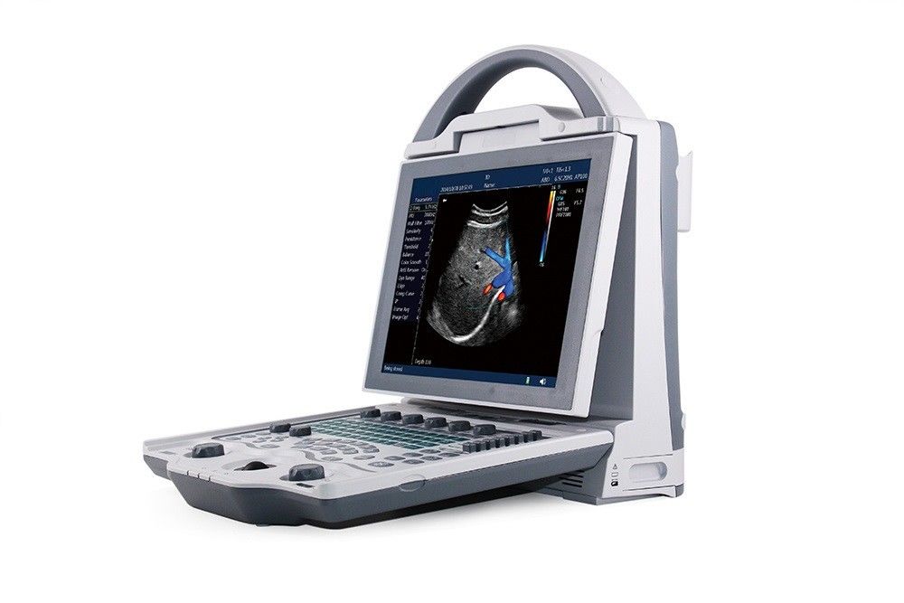 16GB Entry Level 2D Laptop Color Doppler Ultrasound System Untuk Kehamilan