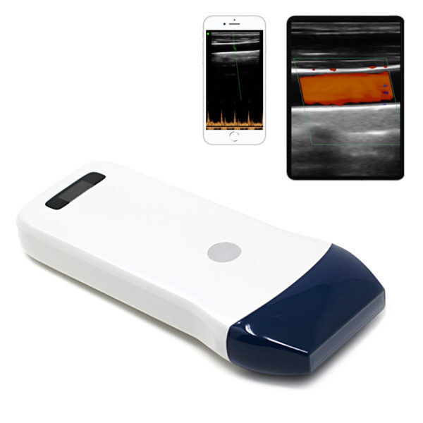 Pemindai Ultrasound Probe Linier Nirkabel untuk Akses Vaskular, Blok Saraf, dan Pencitraan Muskuloskeletal