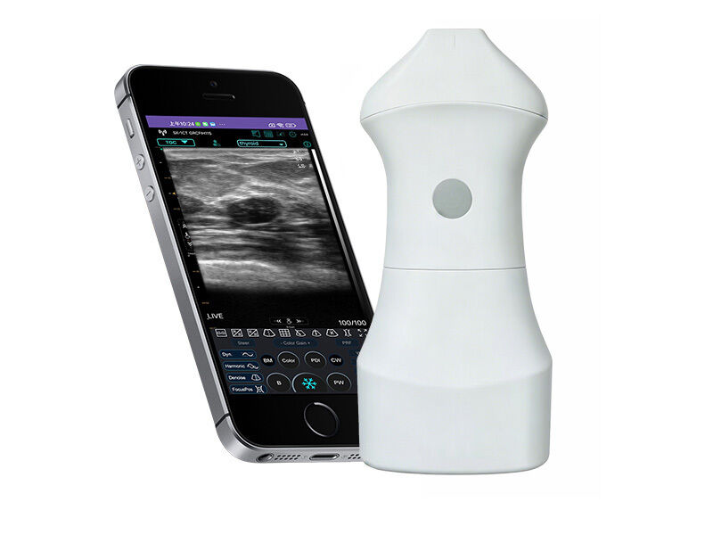 Pemeriksaan Ultrasonografi Kulit Frekuensi Tinggi 24MHz untuk Pengobatan Estetika, Dermatologi, dan Panduan Prosedur Suntikan