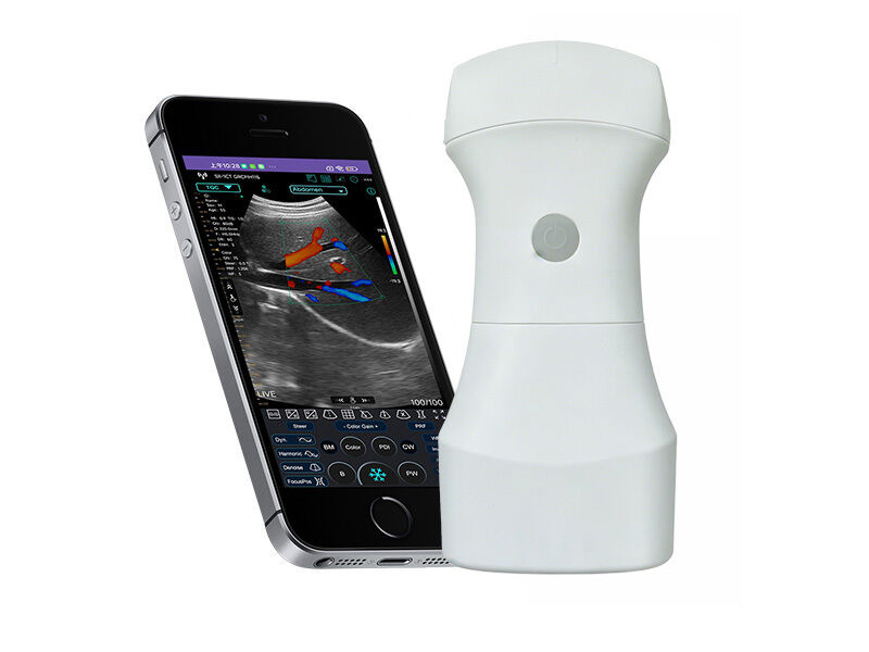 Pemindai Ultrasound Cembung Saku Nirkabel dengan Baterai yang Dapat Diganti untuk Pencitraan Klinis Portabel