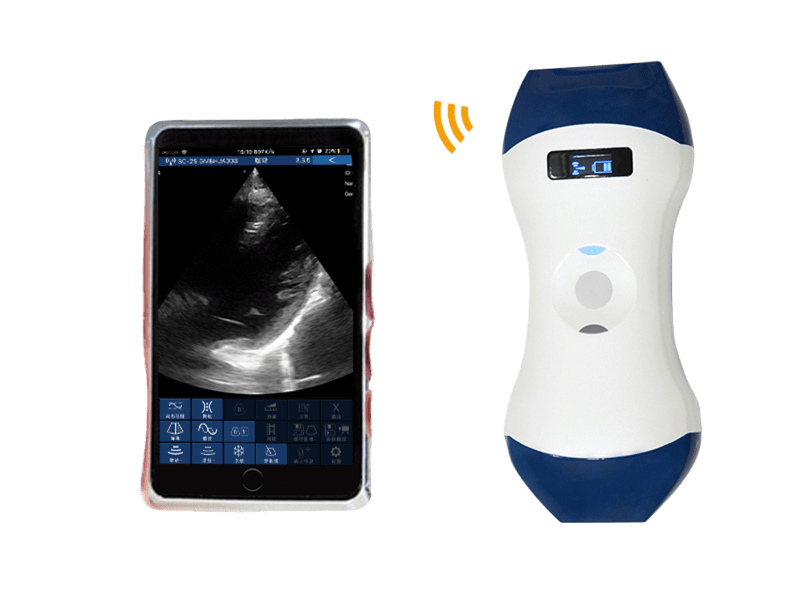 FDA CE ISO13485 Probe Ultrasound Genggam Nirkabel Ukuran Telapak Tangan dengan Array Bertahap dan Kepala Ganda Linear untuk POCUS