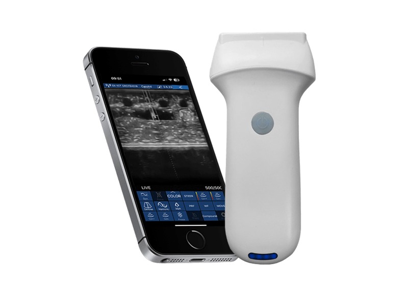 Panduan Tusukan Probe Ultrasound Doppler Warna Linier dengan Panduan Jarum Dalam dan Luar Pesawat untuk Penempatan PICC